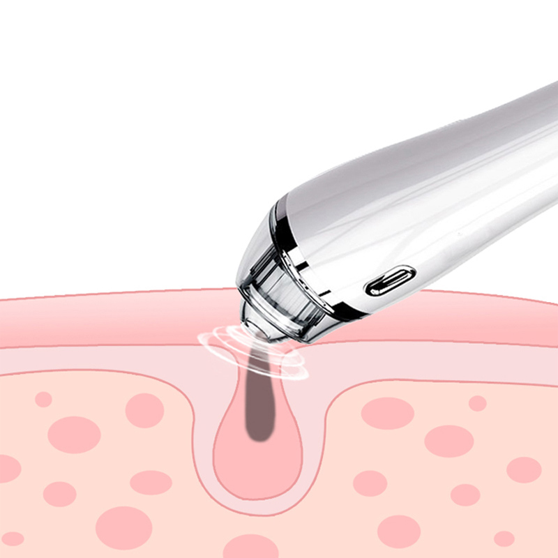 Aspiradora removedor de espinillas - Limpiador de poros Electric Blackhead Suction Facial Comedo Acne Extractor Tool para mujeres y hombres