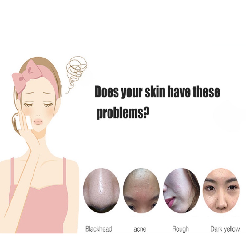 Limpieza profunda Exfoliadores de piel Rejuvenecimiento de la piel Ascensor Facial Ultrasonic Scrubber