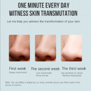 Extractor eléctrico Eliminación de acné Removedor de cabeza de la cabeza de la máquina de la belleza del vacío limpiador de poros