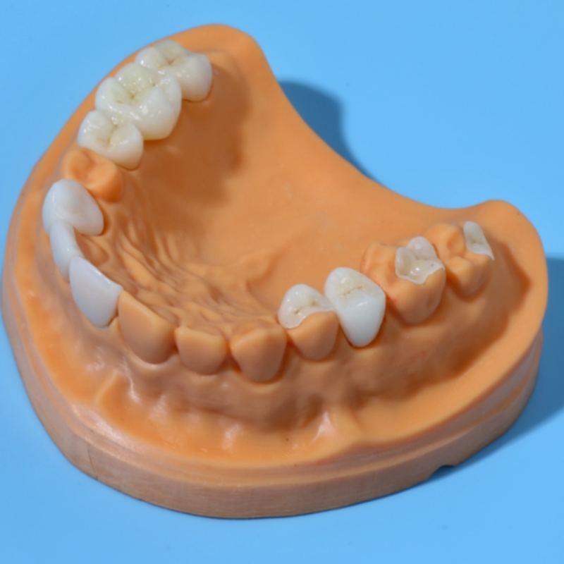 Todo-dientes de cerámica