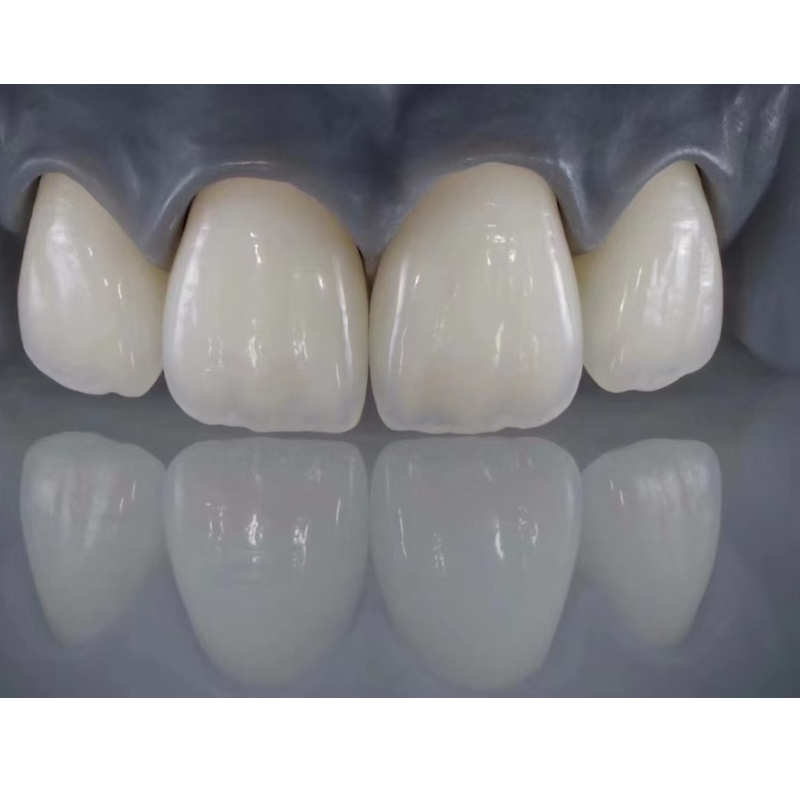 Todo-dientes de cerámica